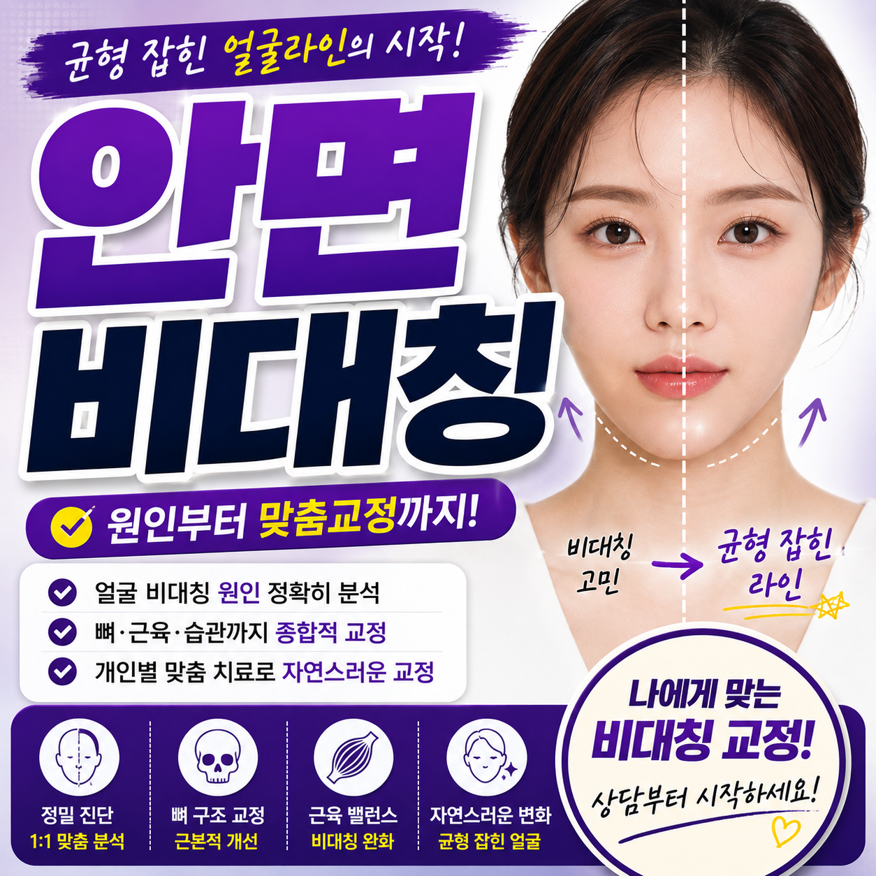 안면비대칭