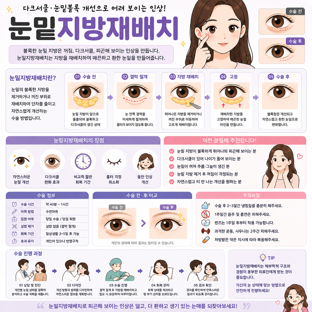 눈밑지방재배치