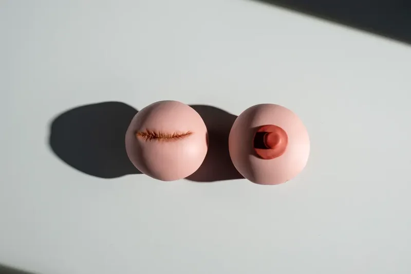 처진가슴수술
