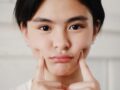 써마지 300샷 가격 600샷 가격 900샷 가격, 금액 차이보다 먼저 비교해야 할 것